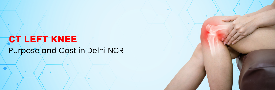 CT Left Knee: Purpose and Cost in Delhi NCR